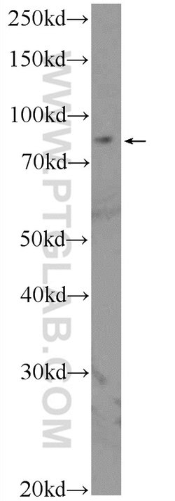 PGBD1 Rabbit anti-Human, Mouse, Polyclonal, Proteintech:Antibodies:Primary