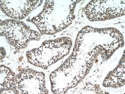 SCML2 Rabbit anti-Human, Mouse, Polyclonal, Proteintech 150 &mu;L | Buy Online | Proteintech | Fisher Scientific