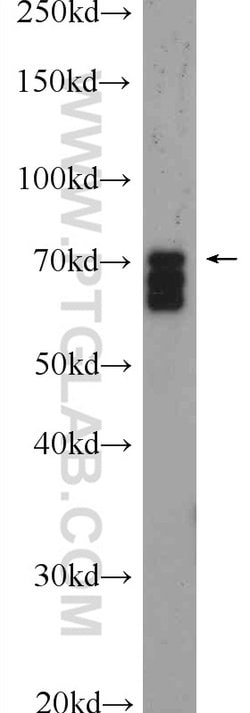 SCML2 Rabbit anti-Human, Mouse, Polyclonal, Proteintech 150 &mu;L | Buy Online | Proteintech | Fisher Scientific