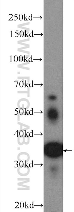 ATRAID Rabbit anti-Human, Mouse, Polyclonal, Proteintech:Anticorps:Anticorps