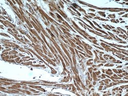 KBTBD10 Rabbit anti-Human, Mouse, Polyclonal, Proteintech:Antibodies:Primary