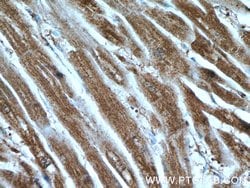 KBTBD10 Rabbit anti-Human, Mouse, Polyclonal, Proteintech:Antibodies:Primary