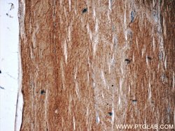 KBTBD10 Rabbit anti-Human, Mouse, Polyclonal, Proteintech:Antibodies:Primary