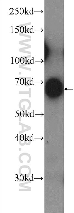 KBTBD10 Rabbit anti-Human, Mouse, Polyclonal, Proteintech:Antibodies:Primary