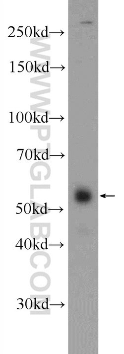 ZNF785 Rabbit anti-Human, Polyclonal, Proteintech 20 &mu;L; Unconjugated:Antibodies,