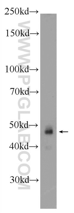 ZNF785 Rabbit anti-Human, Polyclonal, Proteintech 20 &mu;L; Unconjugated:Antibodies,