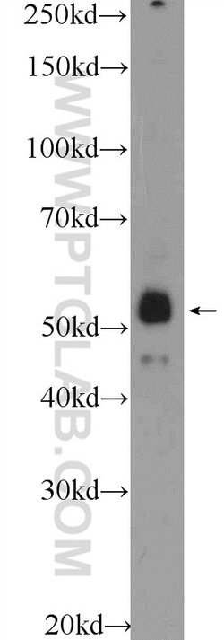 ZNF785 Rabbit anti-Human, Polyclonal, Proteintech 20 &mu;L; Unconjugated:Antibodies,
