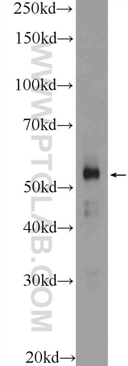 ZNF785 Rabbit anti-Human, Polyclonal, Proteintech 20 &mu;L; Unconjugated:Antibodies,