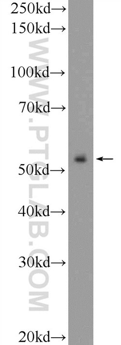 ZNF785 Rabbit anti-Human, Polyclonal, Proteintech 20 &mu;L; Unconjugated:Antibodies,