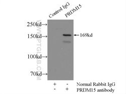 PRDM15 Rabbit anti-Human, Polyclonal, Proteintech 150 &mu;L; Unconjugated:Antibodies,