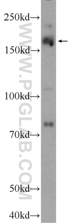 PRDM15 Rabbit anti-Human, Polyclonal, Proteintech 150 &mu;L; Unconjugated:Antibodies,