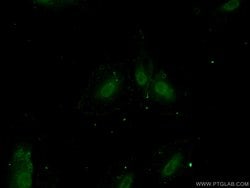ZNF549 Rabbit anti-Human, Polyclonal, Proteintech:Antibodies:Primary Antibodies