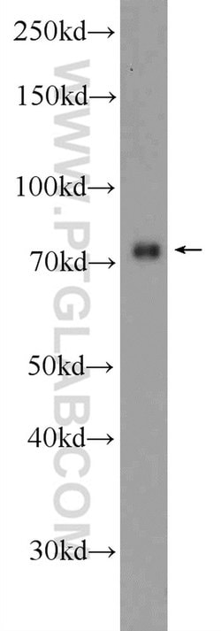 ZNF549 Rabbit anti-Human, Polyclonal, Proteintech:Antibodies:Primary Antibodies