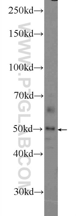 ZNF323 Rabbit anti-Human, Mouse, Polyclonal, Proteintech 20 &mu;L; Unconjugated:Antibodies,