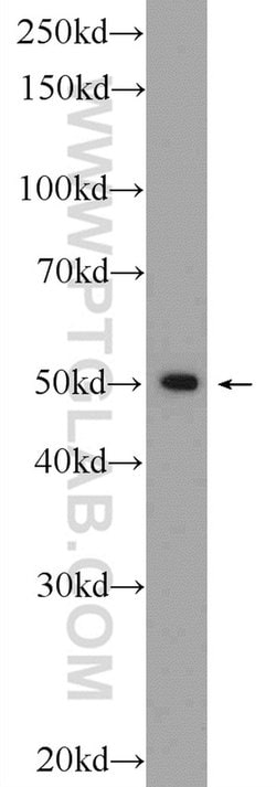 ZNF101 Rabbit anti-Human, Polyclonal, Proteintech 20 &mu;L; Unconjugated:Antibodies,