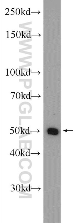 ZNF101 Rabbit anti-Human, Polyclonal, Proteintech 20 &mu;L; Unconjugated:Antibodies,
