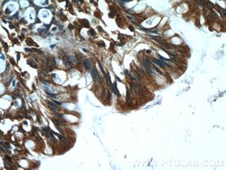 ASB13 Rabbit anti-Human, Mouse, Polyclonal, Proteintech 150 &mu;L; Unconjugated:Antibodies,