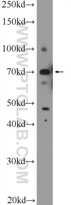 ZBTB22 Rabbit anti-Human, Mouse, Polyclonal, Proteintech 150 &mu;L; Unconjugated:Antibodies,