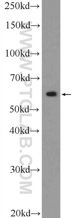 ZBTB22 Rabbit anti-Human, Mouse, Polyclonal, Proteintech 150 &mu;L; Unconjugated:Antibodies,