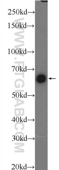 PKM Rabbit anti-Human, Polyclonal, Proteintech 150 &mu;L; Unconjugated:Antibodies,