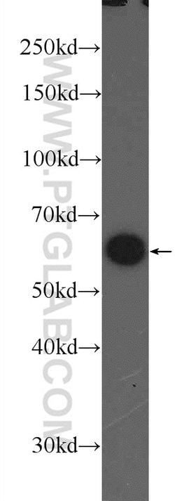 PKM Rabbit anti-Human, Polyclonal, Proteintech 150 &mu;L; Unconjugated:Antibodies,
