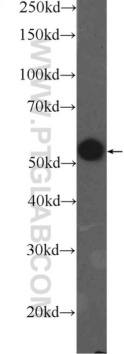 PKM Rabbit anti-Human, Polyclonal, Proteintech 150 &mu;L; Unconjugated:Antibodies,