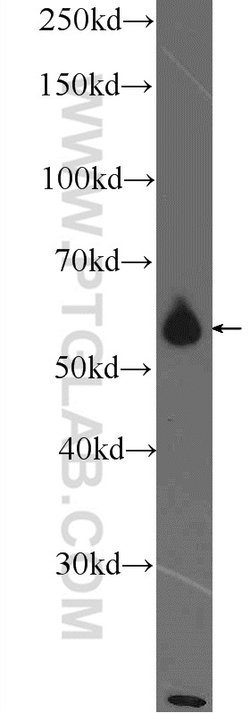 PKM Rabbit anti-Human, Polyclonal, Proteintech 150 &mu;L; Unconjugated:Antibodies,