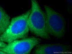 PKM Rabbit anti-Human, Polyclonal, Proteintech 150 &mu;L; Unconjugated:Antibodies,