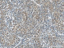 PKM Rabbit anti-Human, Polyclonal, Proteintech 150 &mu;L; Unconjugated:Antibodies,