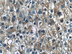 PKM Rabbit anti-Human, Polyclonal, Proteintech 150 &mu;L; Unconjugated:Antibodies,