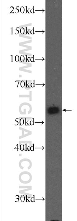 PKM Rabbit anti-Human, Polyclonal, Proteintech 150 &mu;L; Unconjugated:Antibodies,