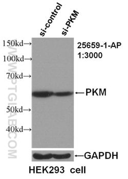 PKM Rabbit anti-Human, Polyclonal, Proteintech 150 &mu;L; Unconjugated:Antibodies,