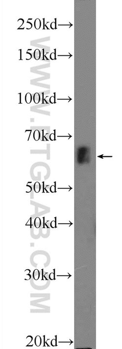 ZNF668 Rabbit anti-Human, Polyclonal, Proteintech 150 &mu;L; Unconjugated:Antibodies,
