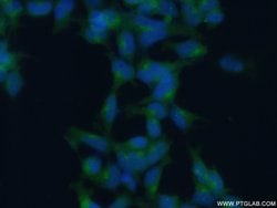 GGA1 Rabbit anti-Human, Mouse, Rat, Polyclonal, Proteintech:Antibodies:Primary