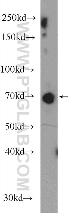 GGA1 Rabbit anti-Human, Mouse, Rat, Polyclonal, Proteintech:Antibodies:Primary