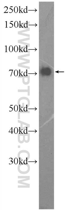 GGA1 Rabbit anti-Human, Mouse, Rat, Polyclonal, Proteintech:Antibodies:Primary