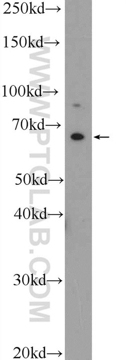 IL1RL2 Rabbit anti-Human, Polyclonal, Proteintech 150 &mu;L | Buy Online | Proteintech Group Inc | Fisher Scientific