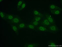 API5 Rabbit anti-Human, Mouse, Polyclonal, Proteintech 150 &mu;L; Unconjugated:Antibodies,