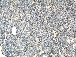API5 Rabbit anti-Human, Mouse, Polyclonal, Proteintech 150 &mu;L; Unconjugated:Antibodies,