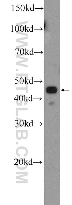API5 Rabbit anti-Human, Mouse, Polyclonal, Proteintech 150 &mu;L; Unconjugated:Antibodies,