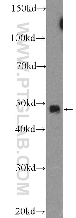 API5 Rabbit anti-Human, Mouse, Polyclonal, Proteintech 150 &mu;L; Unconjugated:Antibodies,