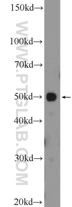 API5 Rabbit anti-Human, Mouse, Polyclonal, Proteintech 150 &mu;L; Unconjugated:Antibodies,