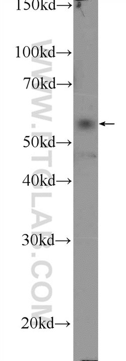 API5 Rabbit anti-Human, Mouse, Polyclonal, Proteintech 150 &mu;L; Unconjugated:Antibodies,