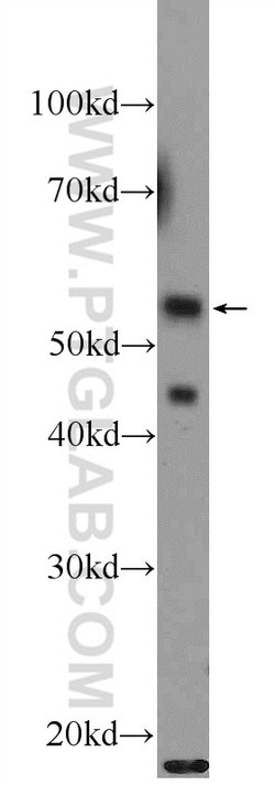 API5 Rabbit anti-Human, Mouse, Polyclonal, Proteintech 150 &mu;L; Unconjugated:Antibodies,