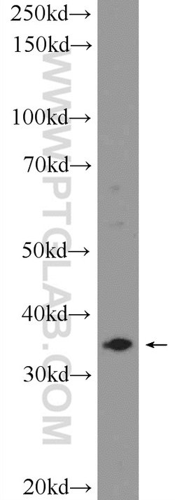 ARMCX3 Rabbit anti-Human, Mouse, Polyclonal, Proteintech:Antibodies:Primary