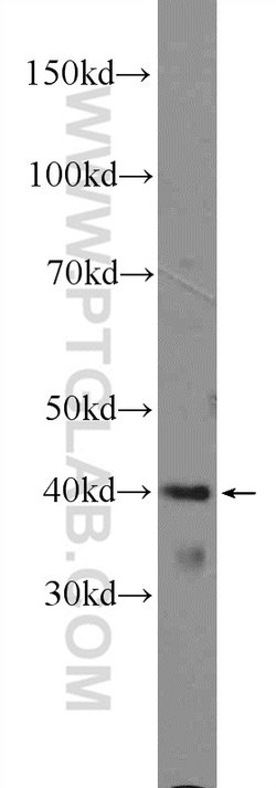 ARMCX3 Rabbit anti-Human, Mouse, Polyclonal, Proteintech:Antibodies:Primary