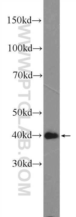 ARMCX3 Rabbit anti-Human, Mouse, Polyclonal, Proteintech:Antibodies:Primary