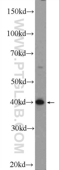 ARMCX3 Rabbit anti-Human, Mouse, Polyclonal, Proteintech:Antibodies:Primary