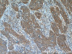 BLOC1S3 Rabbit anti-Human, Polyclonal, Proteintech 150 &mu;L; Unconjugated:Antibodies,