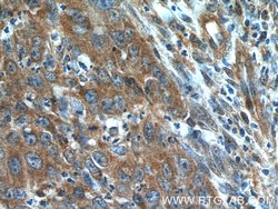 BLOC1S3 Rabbit anti-Human, Polyclonal, Proteintech 150 &mu;L; Unconjugated:Antibodies,